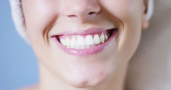 Things To Know About Dental Office Take Home Teeth Whitening Trays