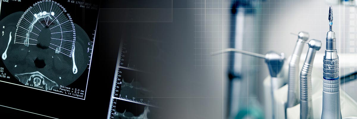 Huntsville Will I Need a Bone Graft for Dental Implants?