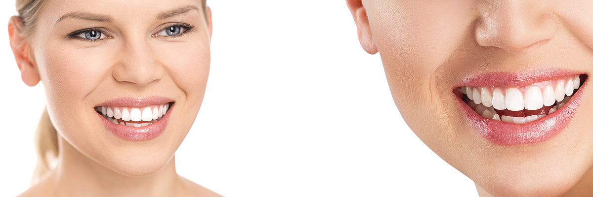 Huntsville Cosmetic Dental Care