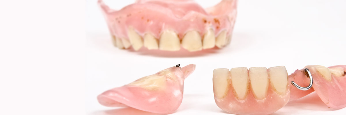 Huntsville What Do I Do If I Damage My Dentures?