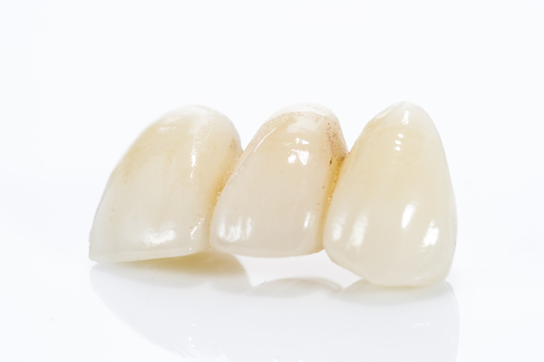 What Is A Dental Bridge?