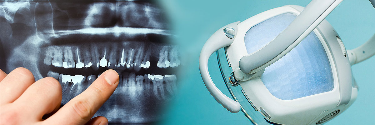 Huntsville Dental Cleaning