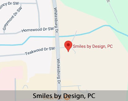 Map image for Options for Replacing Missing Teeth in Huntsville, AL