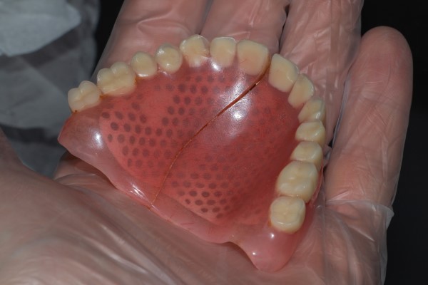 Common Reasons For Denture Repair