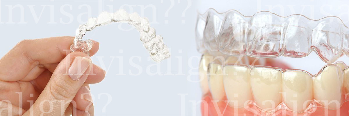 Huntsville Does Invisalign® Really Work?