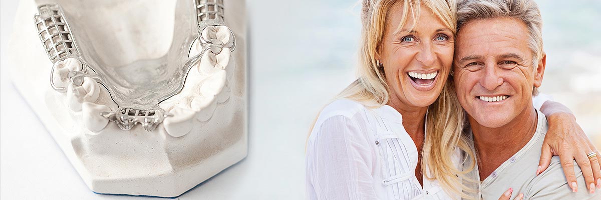 Huntsville Implant Supported Dentures