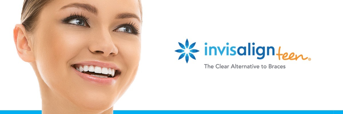 Huntsville Invisalign vs Traditional Braces