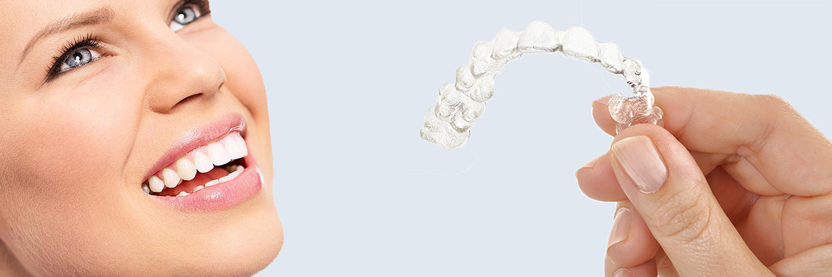 Huntsville 7 Things Parents Need to Know About Invisalign Teen