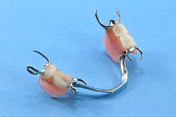 Partial Denture Options for Replacing Missing Teeth from Smiles by Design, PC in Huntsville, AL