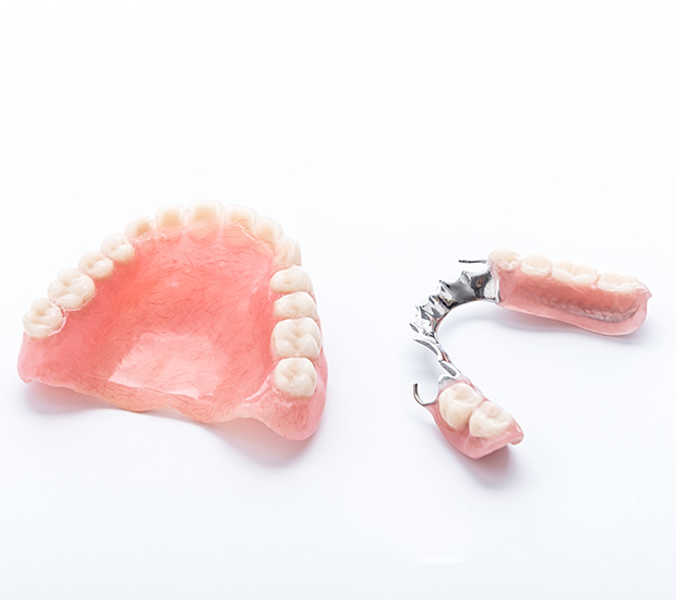 Huntsville Partial Dentures for Back Teeth