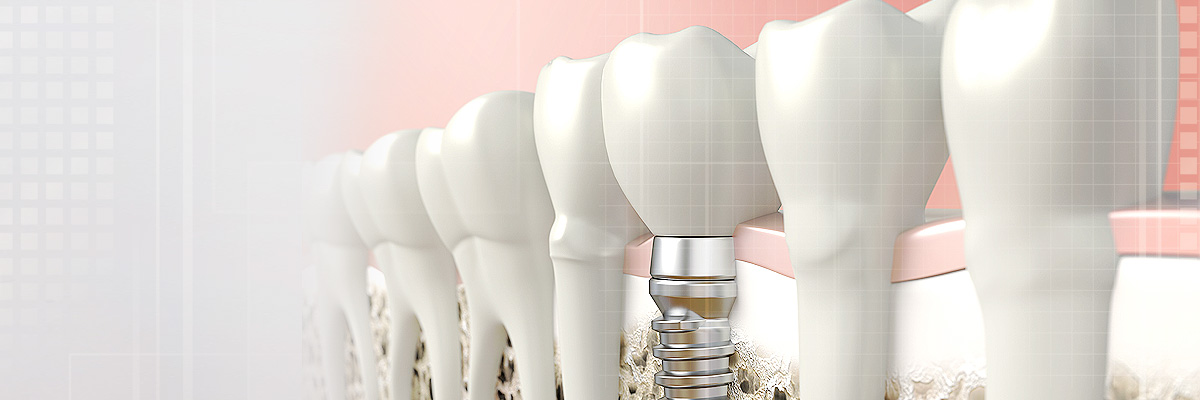Huntsville Oral Prosthetics Doctor