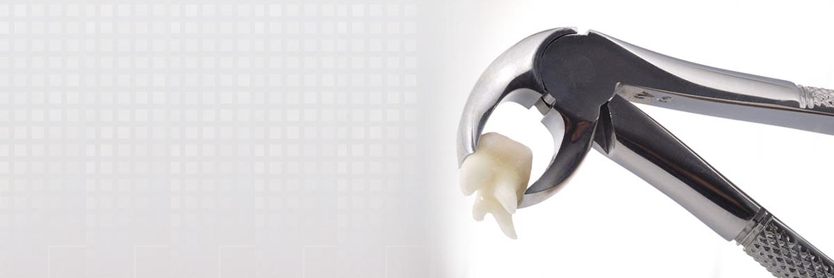 Huntsville Tooth Extraction