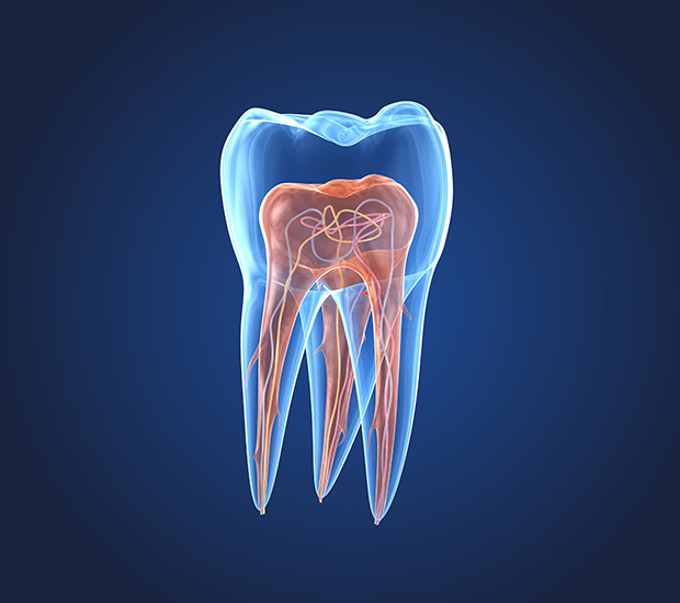 Huntsville What is an Endodontist